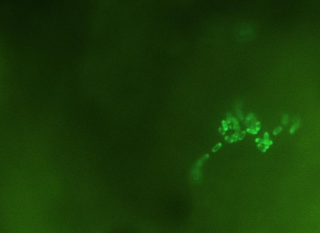 Sandfly gut bacteria transformed to express green fluorescent protein. Dr Rod Dillon