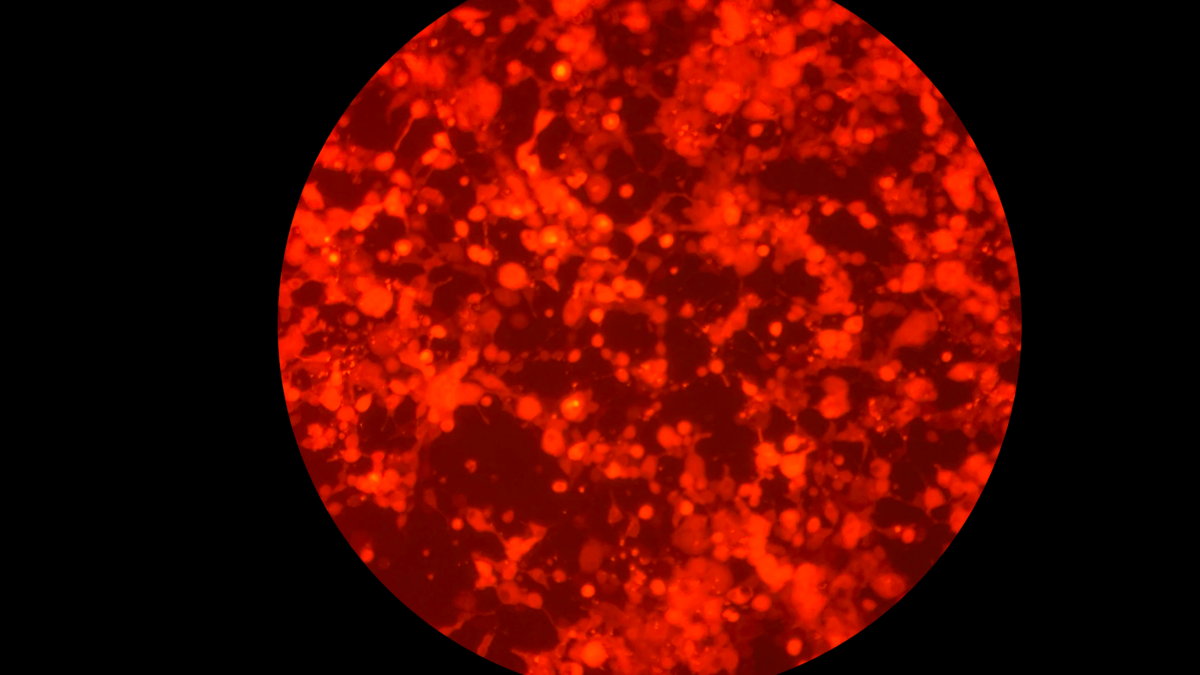 Lovesick: The Transfection \\ Heather Dewey-Hagborg